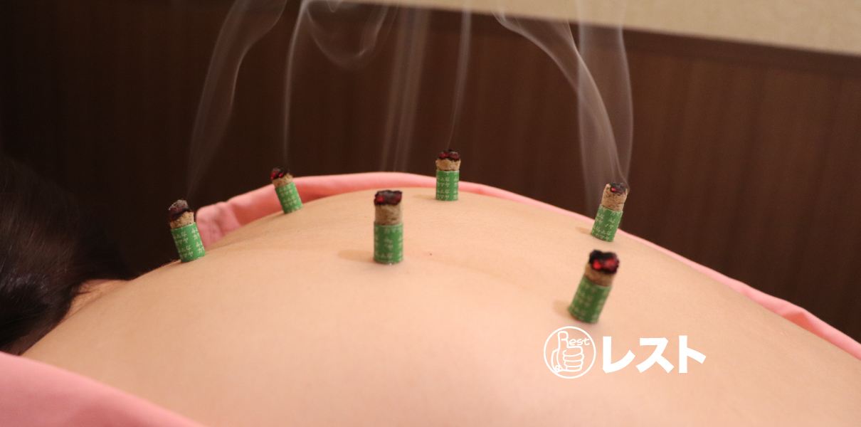 横浜鍼灸指圧マッサージレスト院内　お灸